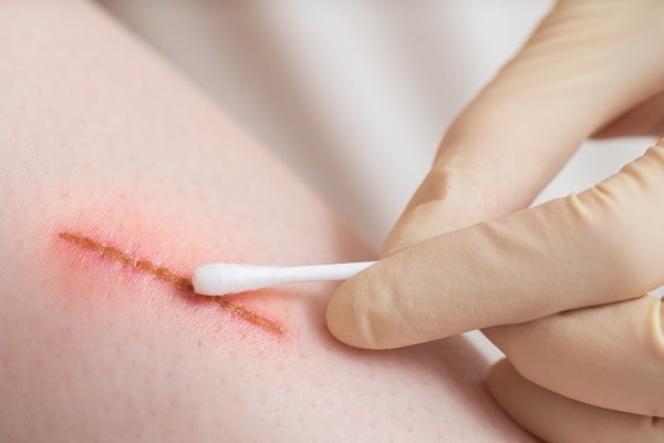 how to heal a cut fast