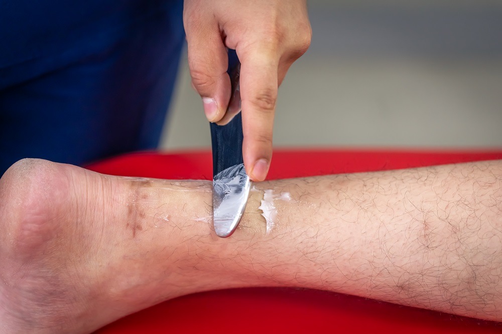 Vascular Wound